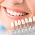 Conoce los riesgos de blanquear tus dientes en casa 26 Sonrisa Blanca