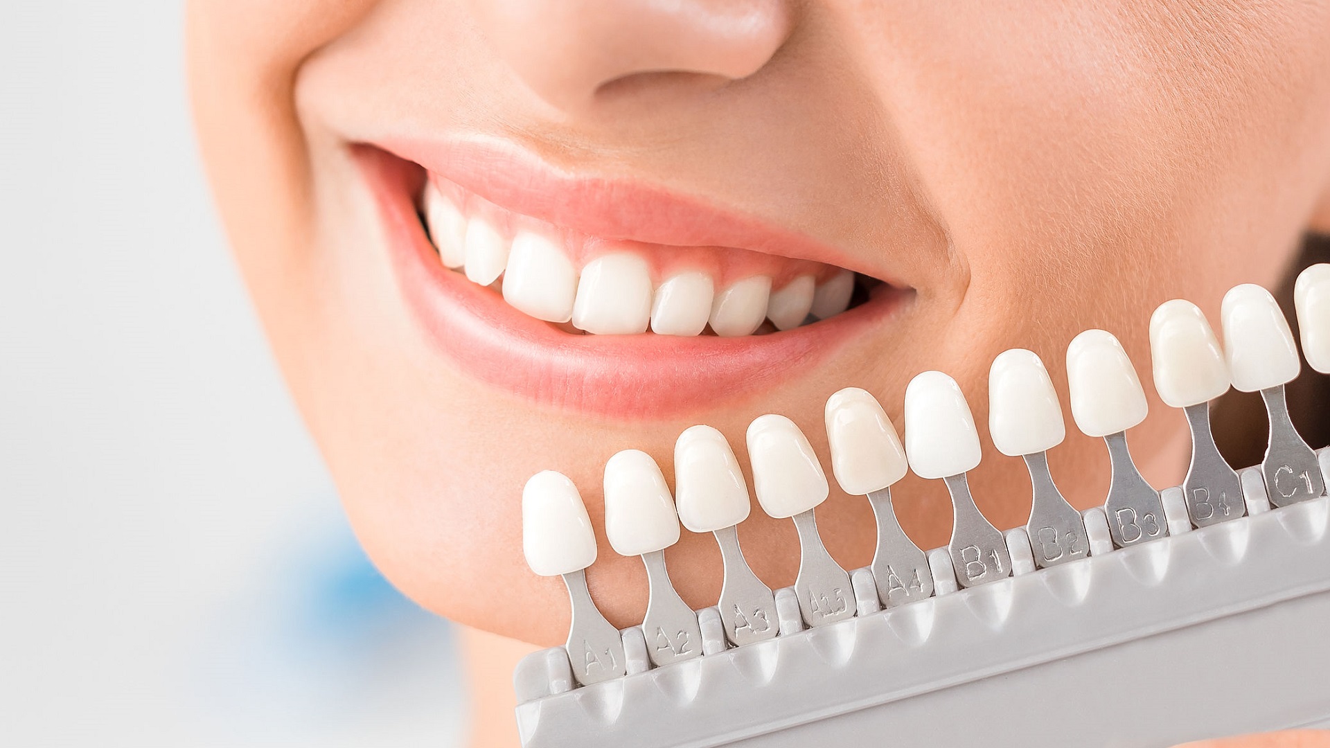 Conoce los riesgos de blanquear tus dientes en casa 10 Sonrisa Blanca