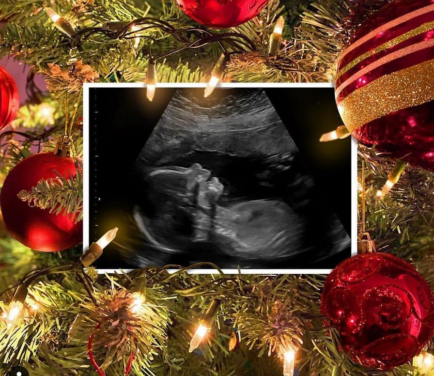 Influencers y famosas embarazadas: los bebés que llegarán este 2021 1 Influencers y famosas embarazadas