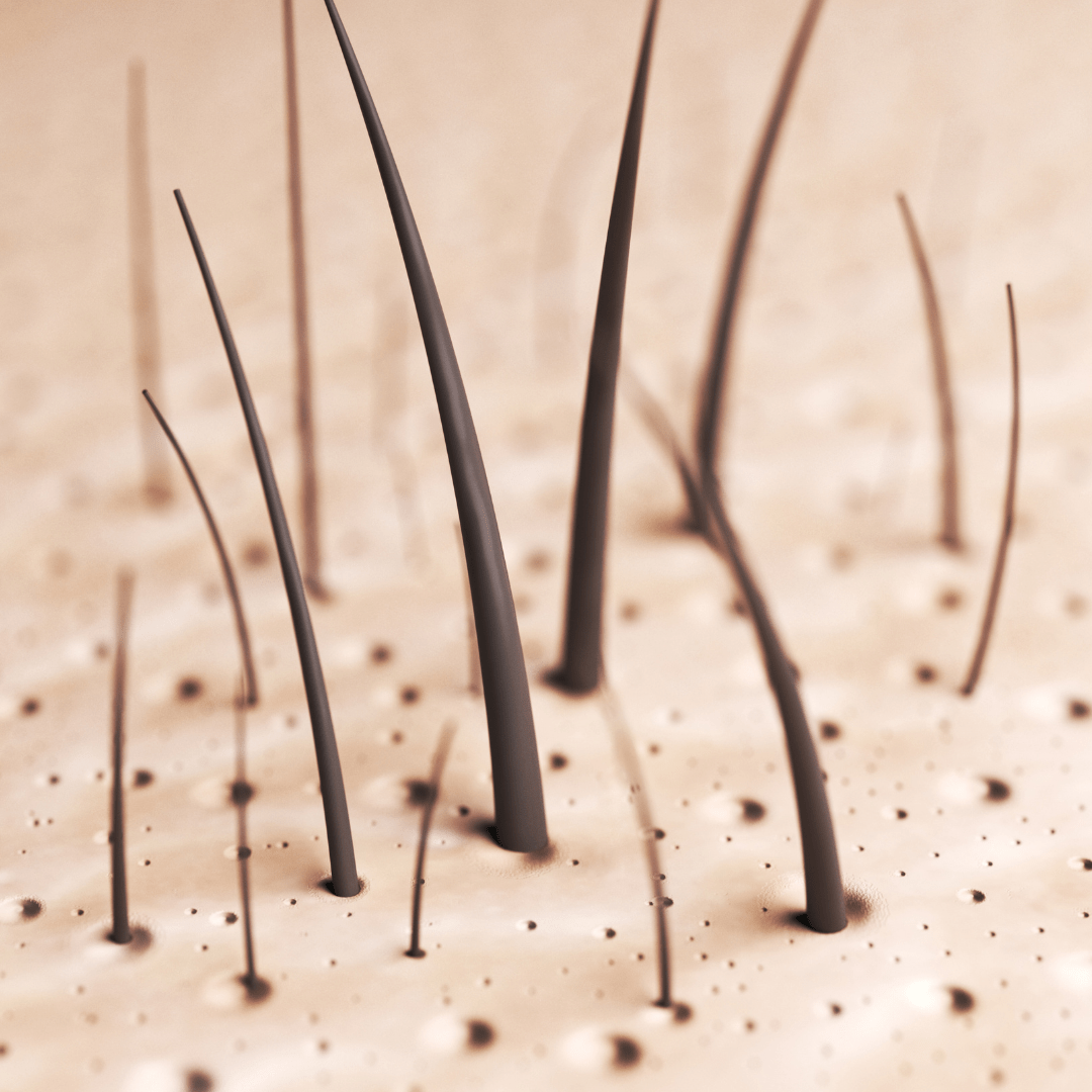 La importancia de un injerto capilar de calidad: ventajas físicas y psicológicas 2